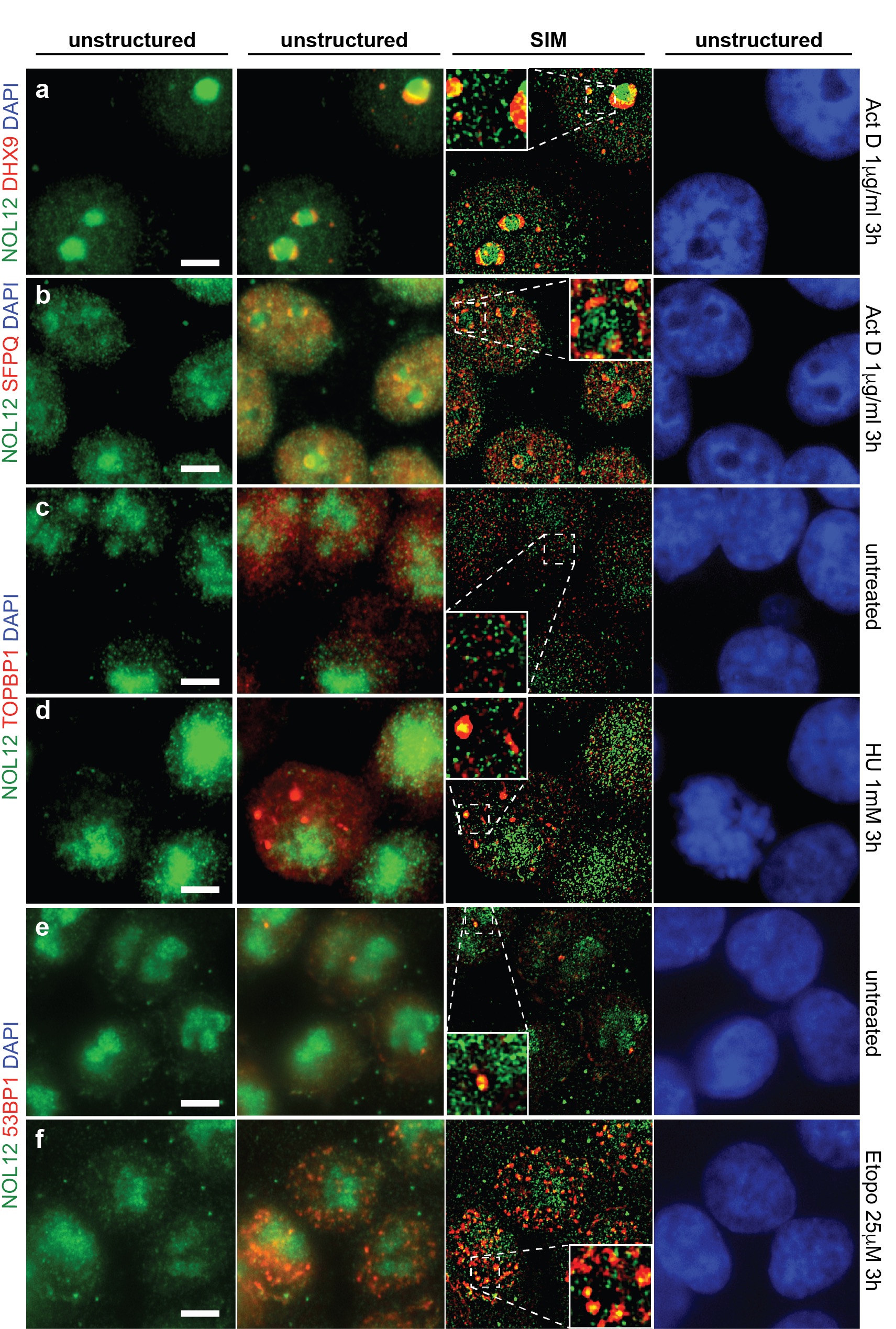 RNA Binding Proteins & genome integrity | Oeffinger Lab
